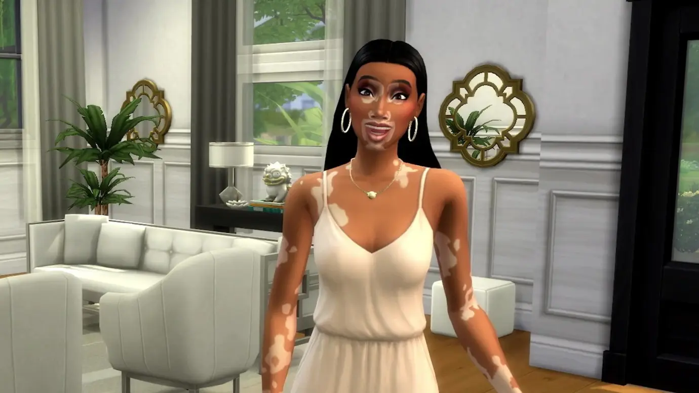 The-Sims-4-Winnie.webp 免费模拟人生 4 更新增加了与 Winnie Harlow 合作的白癜风皮肤细节  PC Xbox PS4 Mac 模拟 角色扮演 模拟人生 资讯 第1张